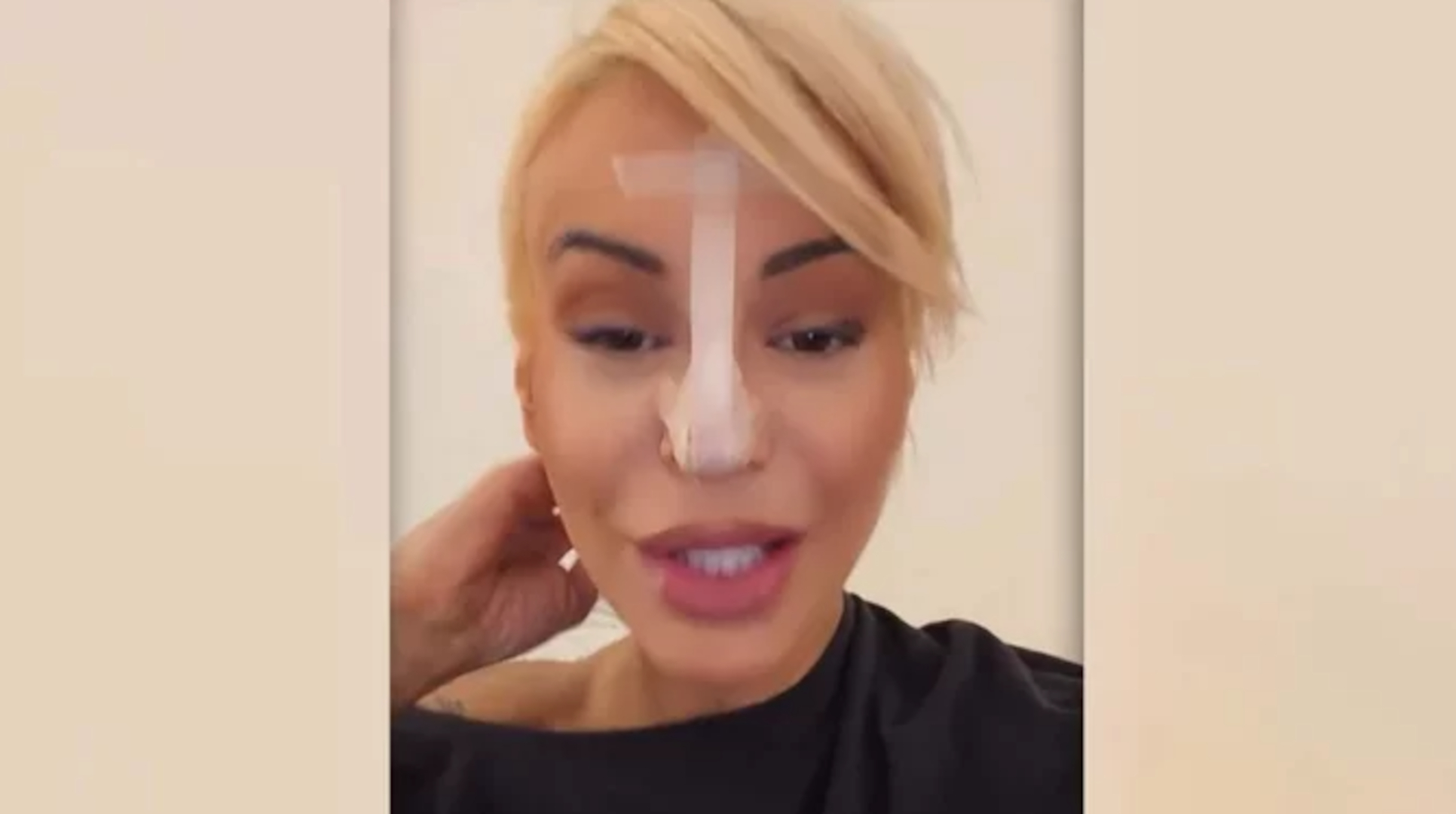 Dušica Jakovljević sa zavojima na licu! Voditeljka zabrinula javnost, otkriveno šta joj se dogodilo (FOTO)