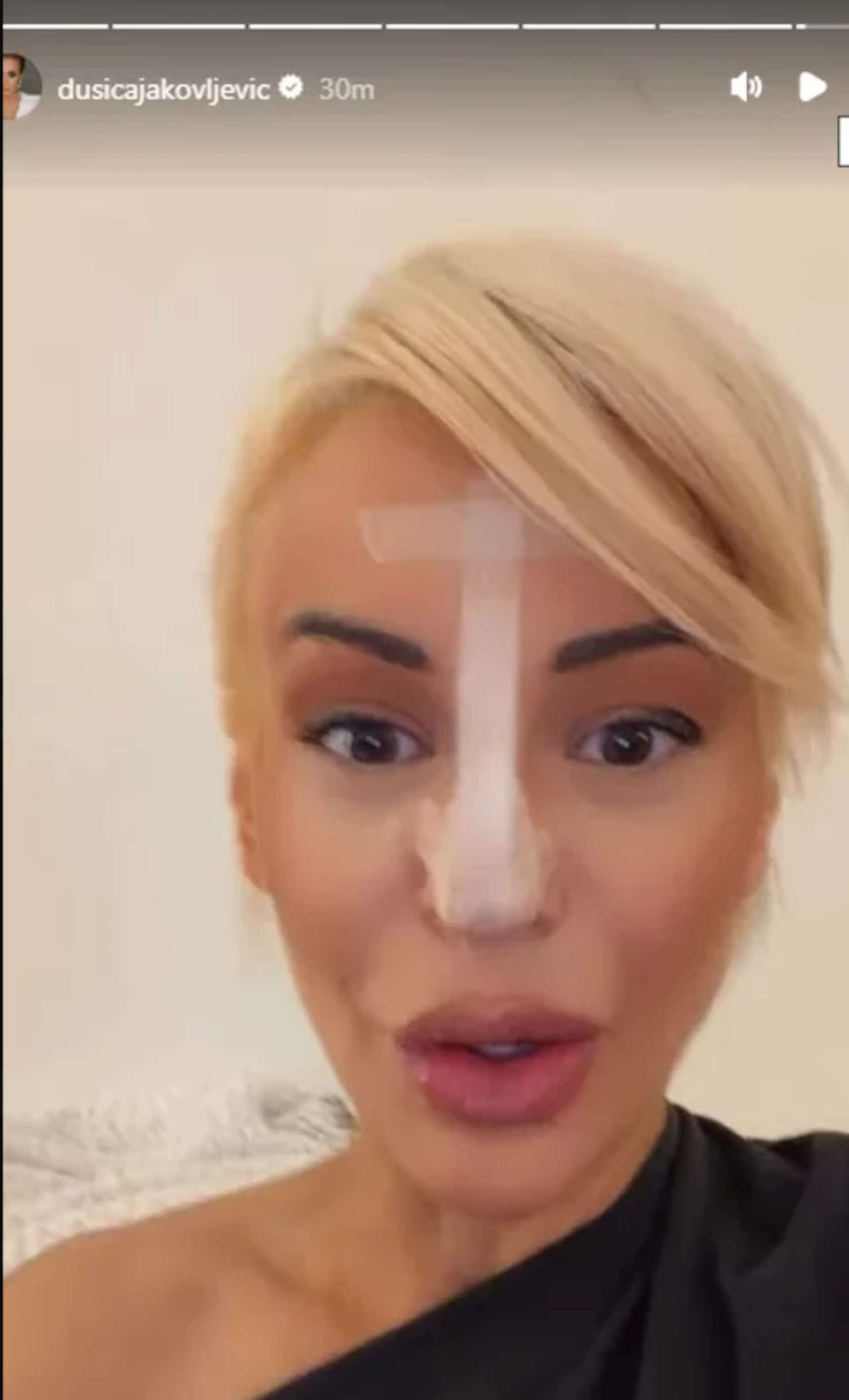 Dušica Jakovljević sa zavojima na licu! Voditeljka zabrinula javnost, otkriveno šta joj se dogodilo (FOTO)