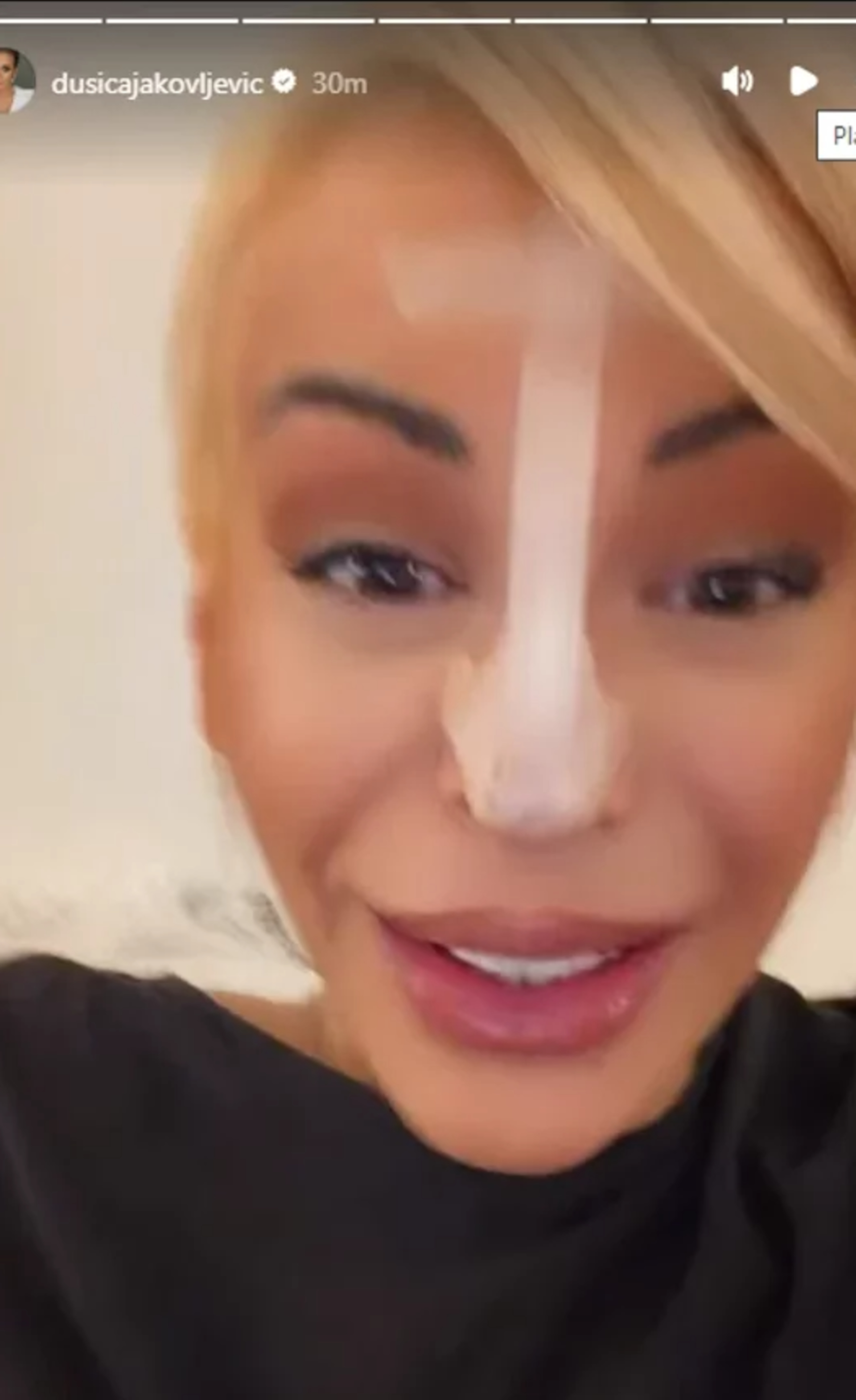 Dušica Jakovljević sa zavojima na licu! Voditeljka zabrinula javnost, otkriveno šta joj se dogodilo (FOTO)