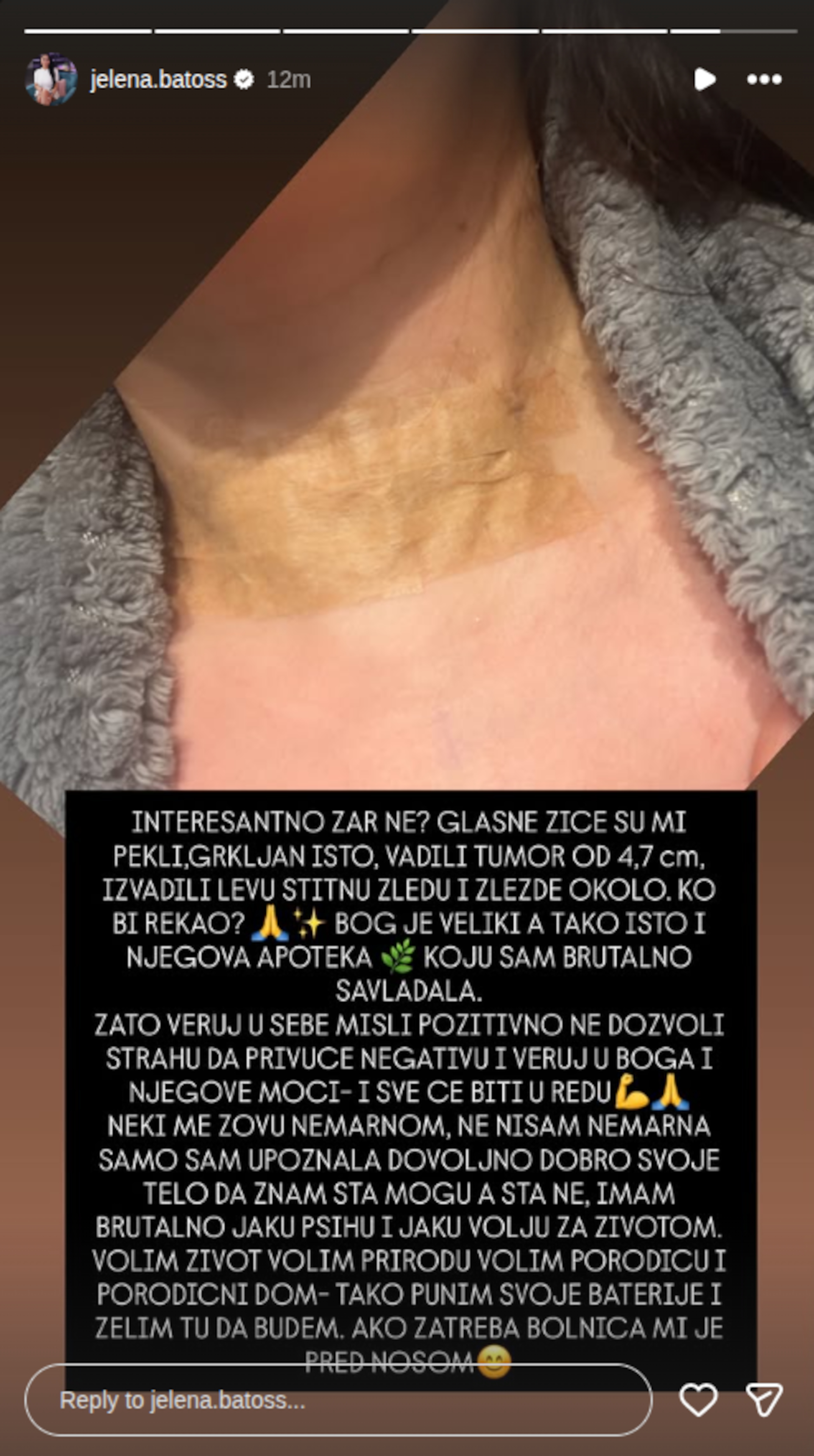 "Da li sam rekla deci sve što mi je na srcu?" Bivša zadrugarka operisana zbog tumora na glavi: Plašila se da se neće probuditi!
