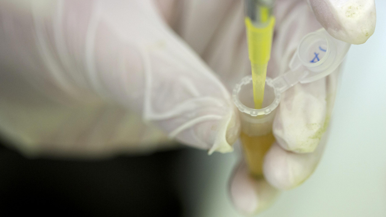 Ebola