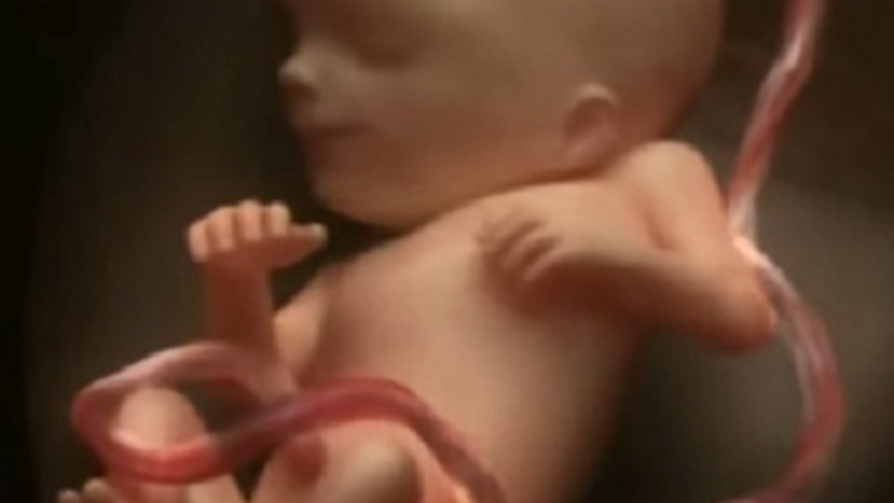 fetus