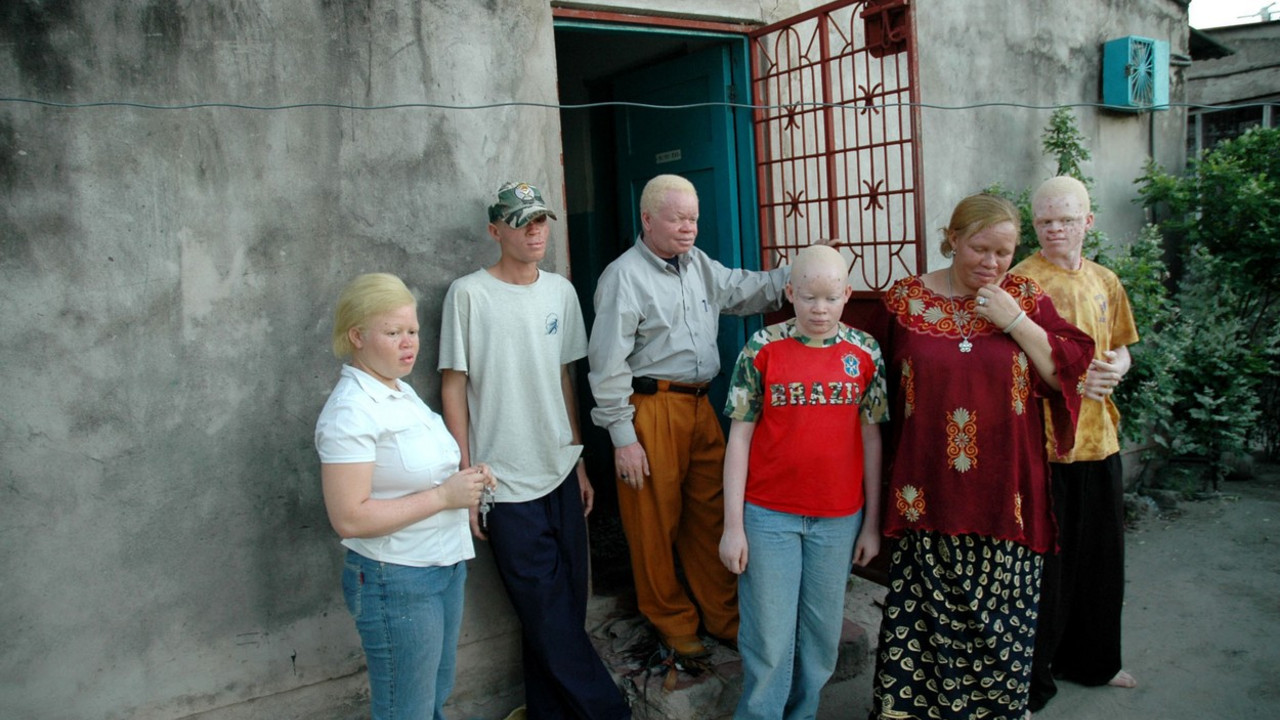 Albino porodica u Tanzaniji
