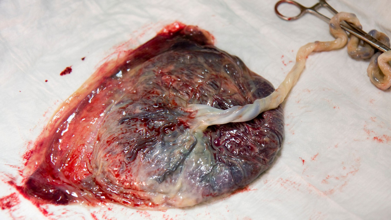 placenta