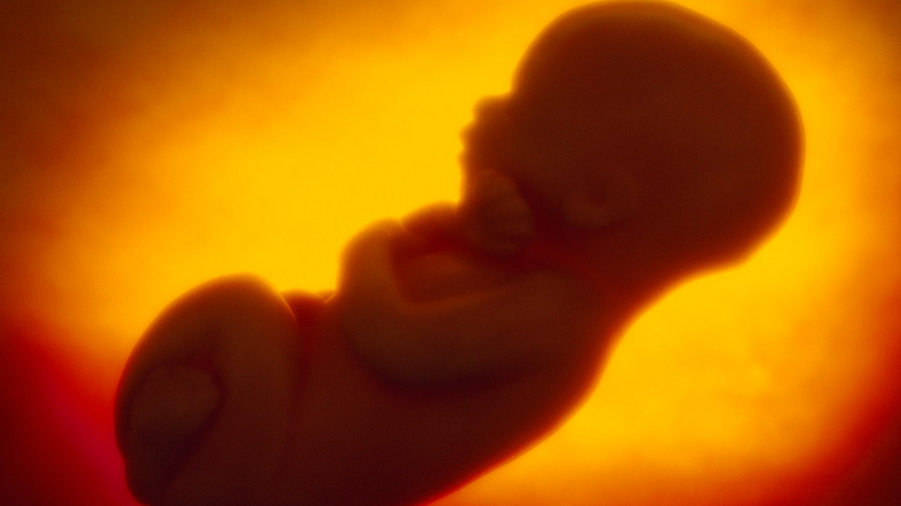 fetus