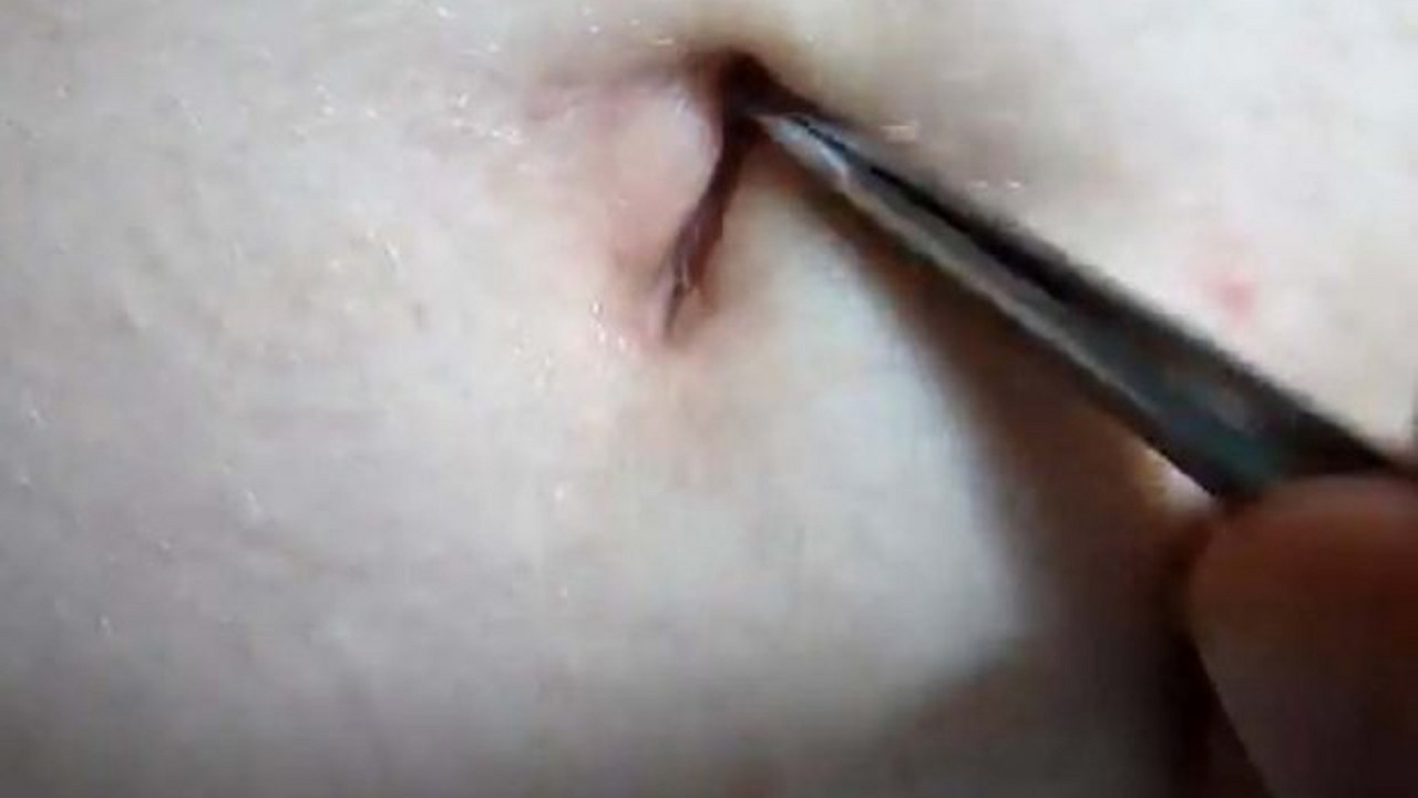Pupak