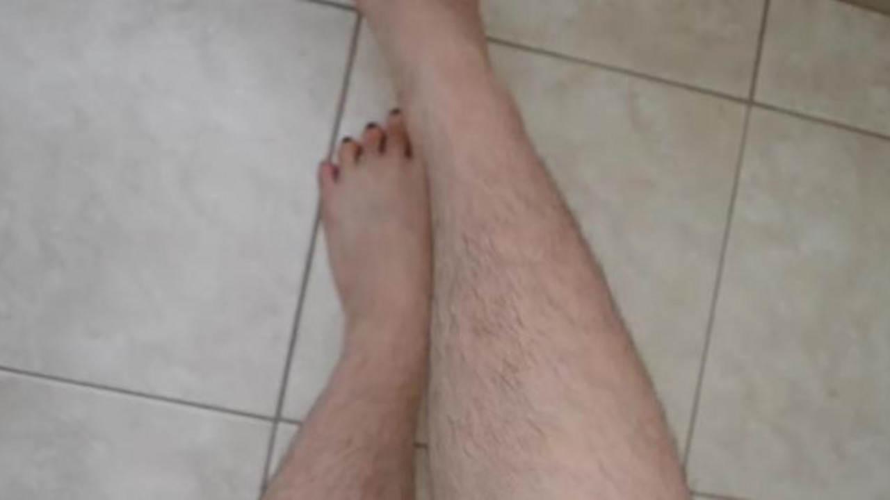 dlakave noge