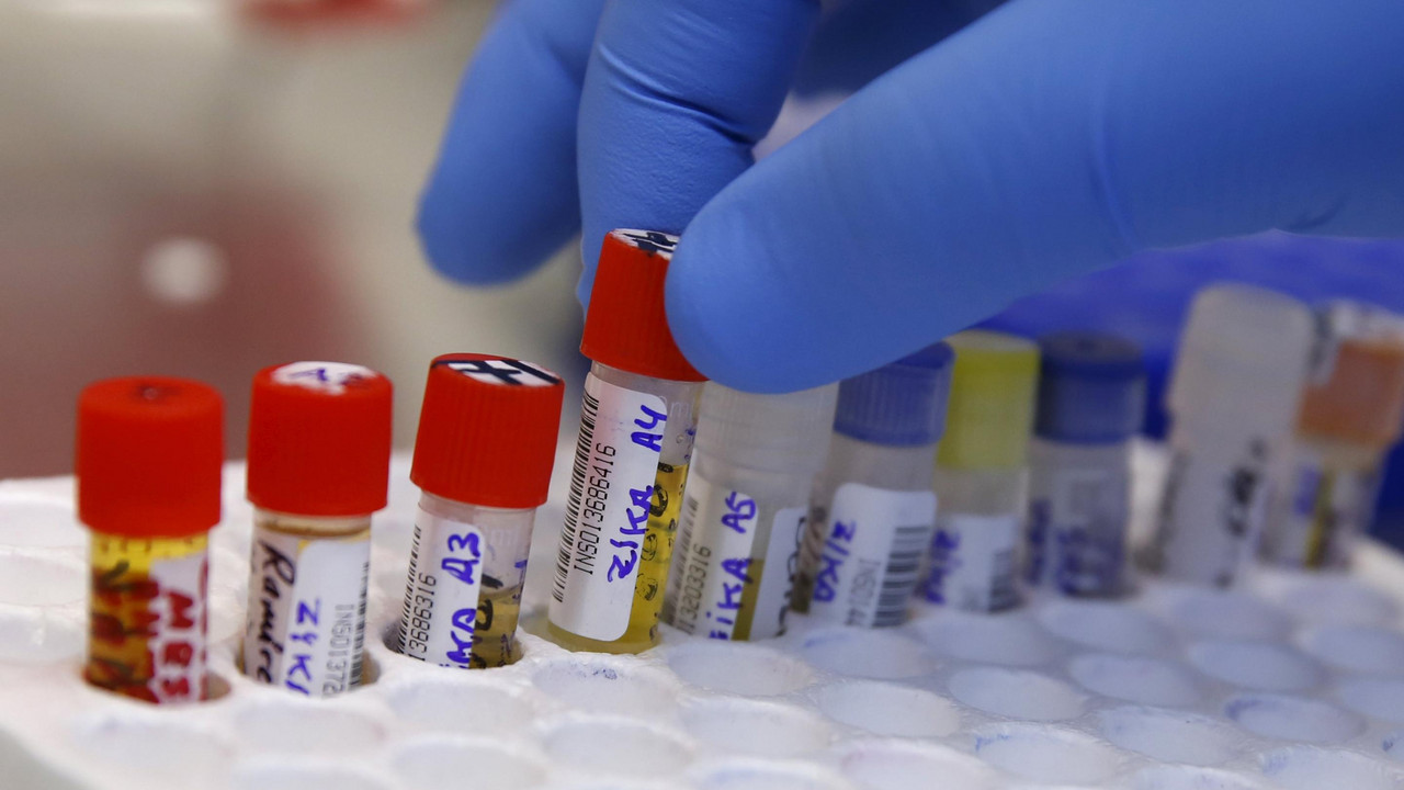 Zika virus