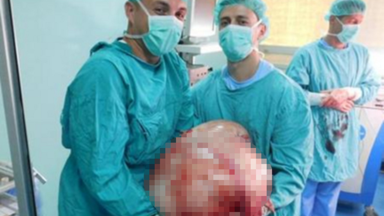Tumor