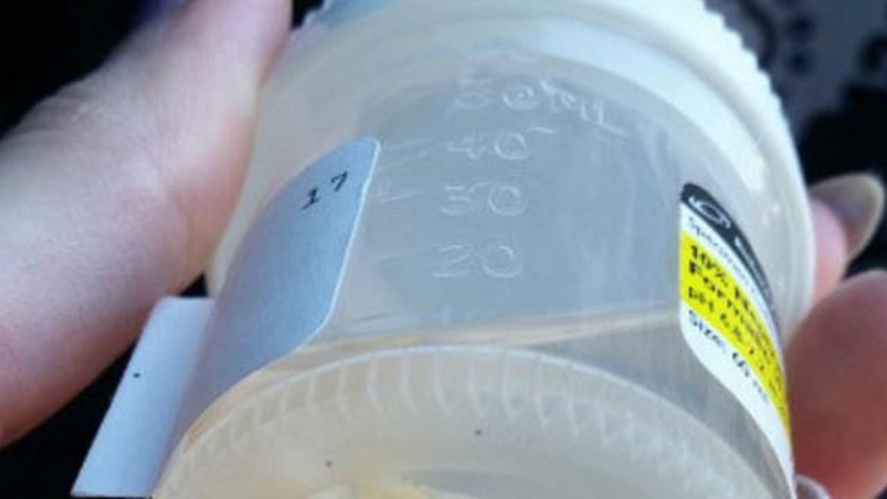 prst u kutiji