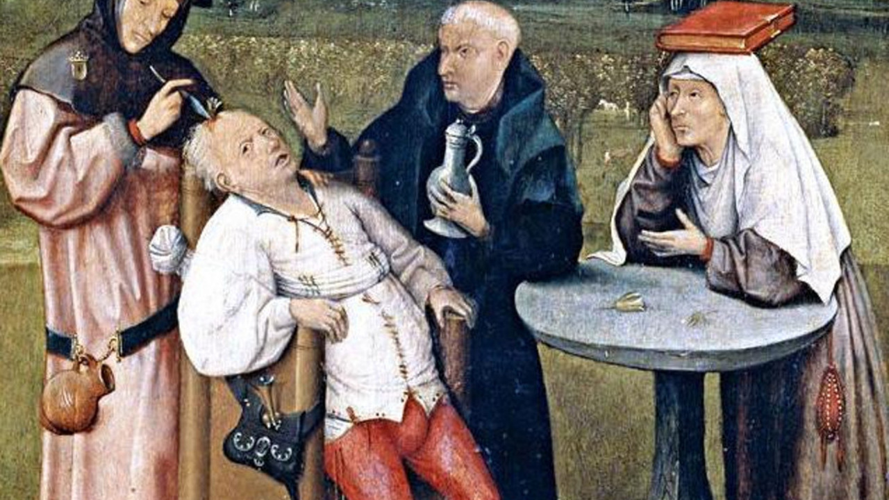 trepanacija