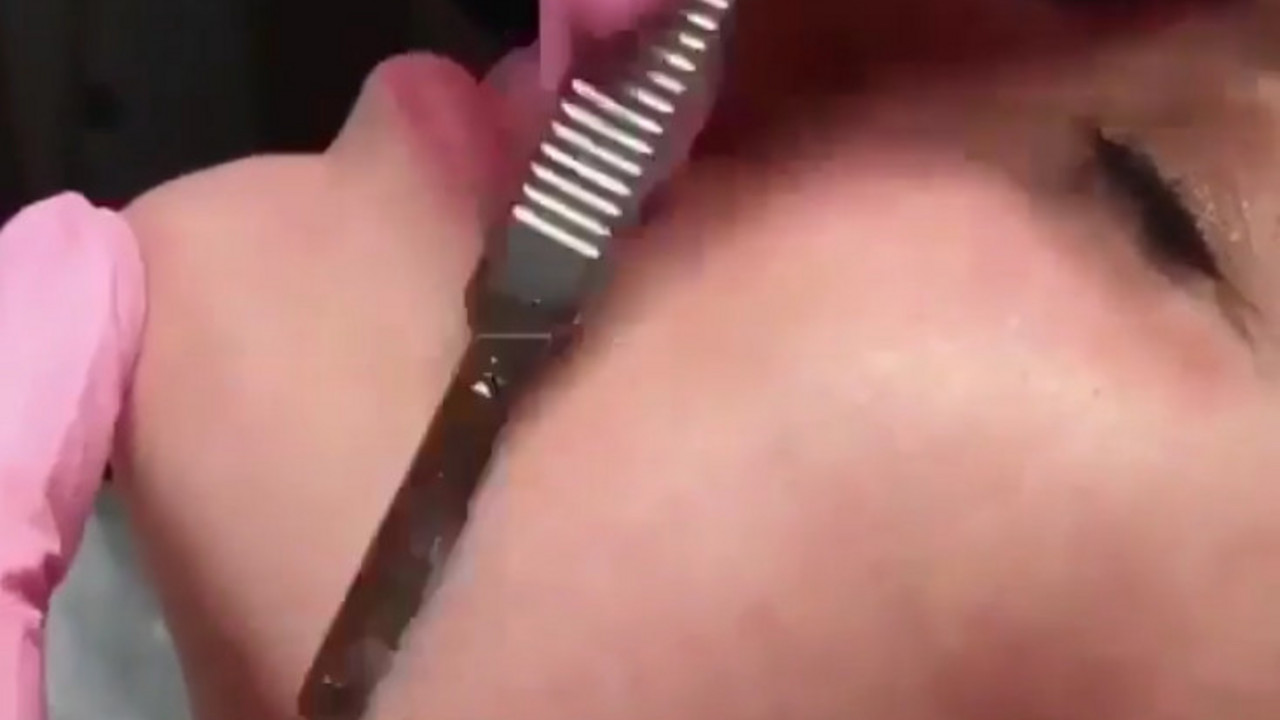 lice