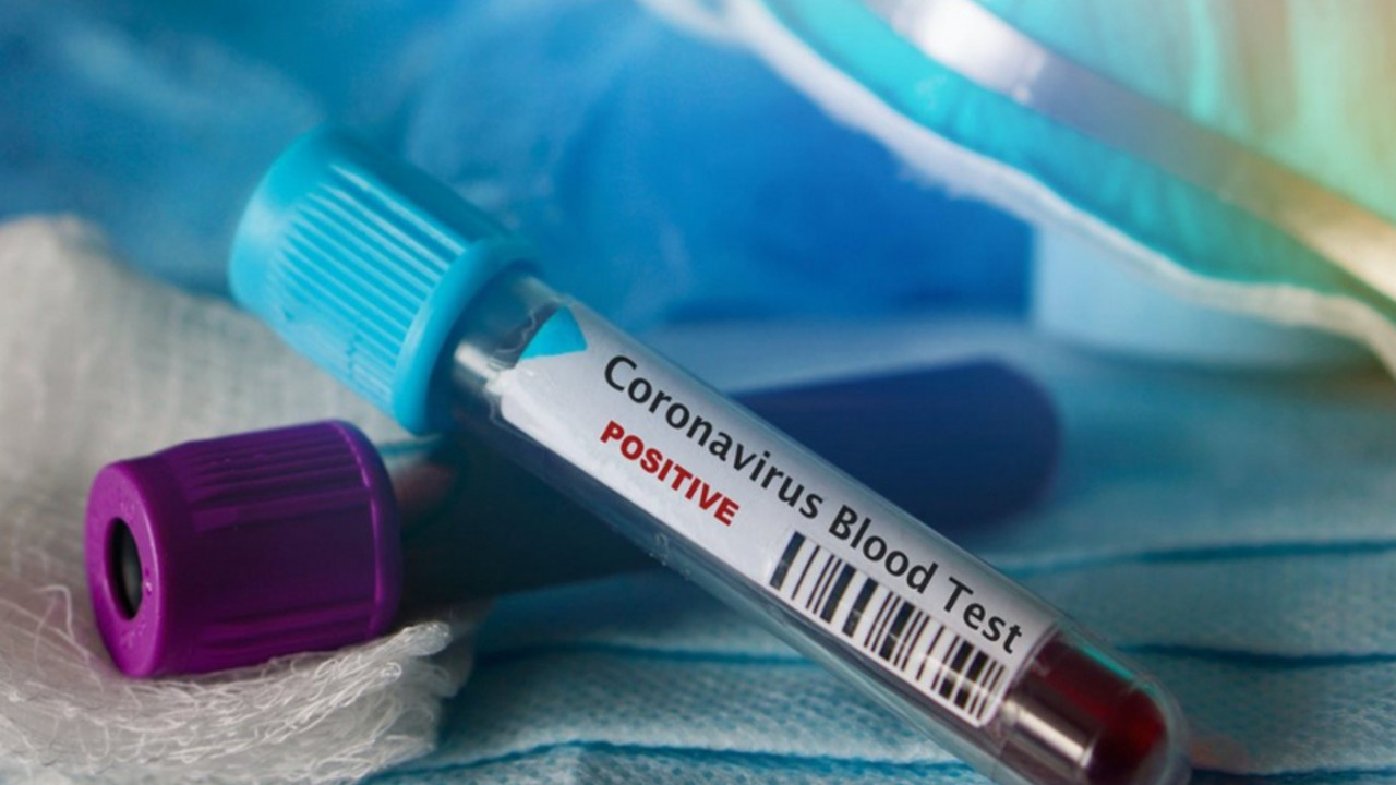 koronavirus