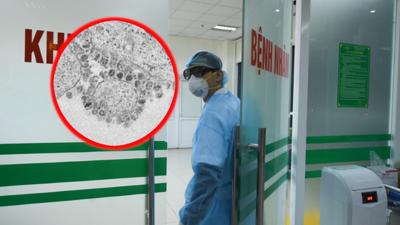 Virus