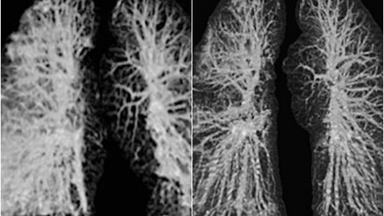 korona virus