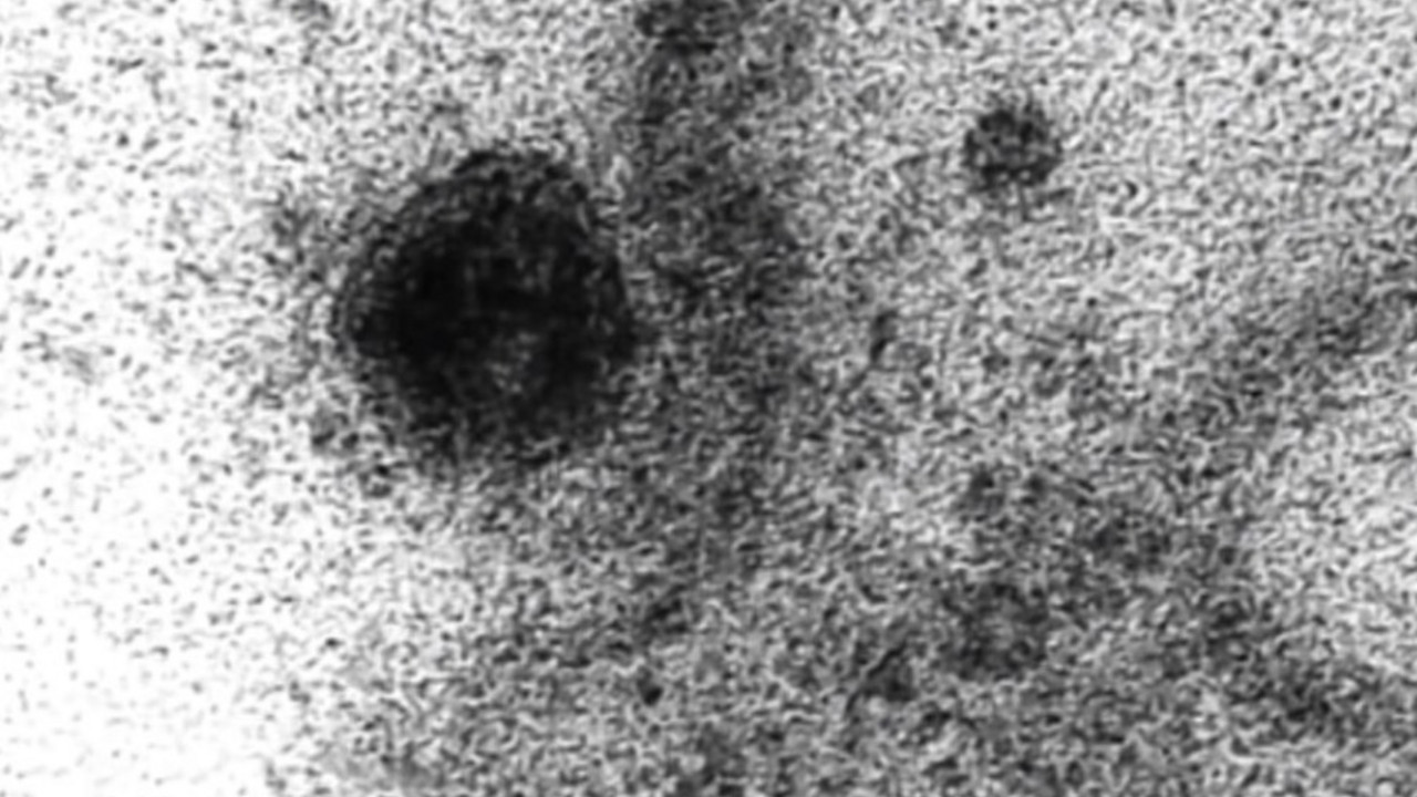 koronavirus