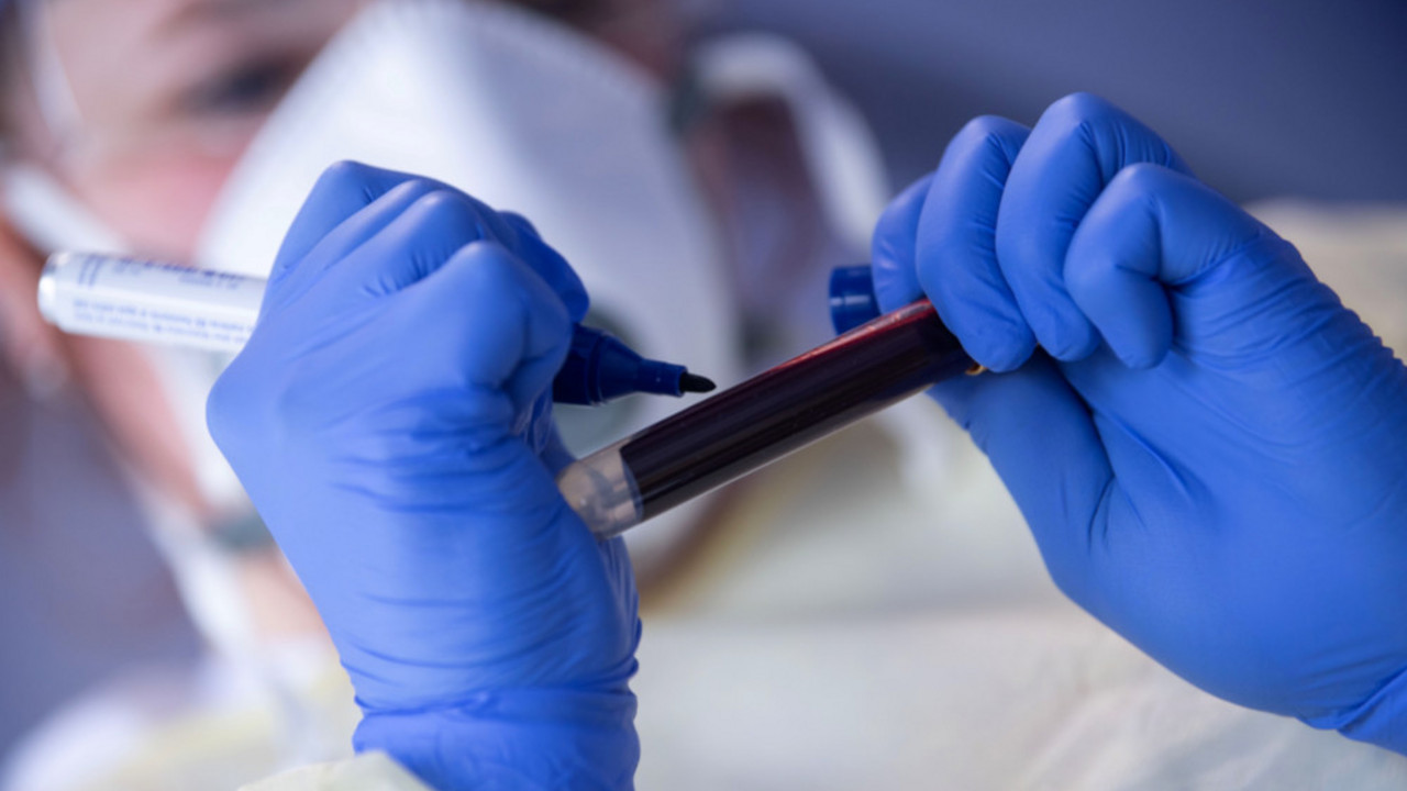 korona virus