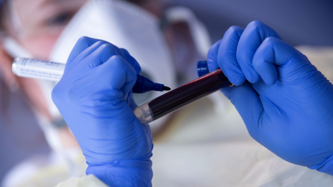 korona virus