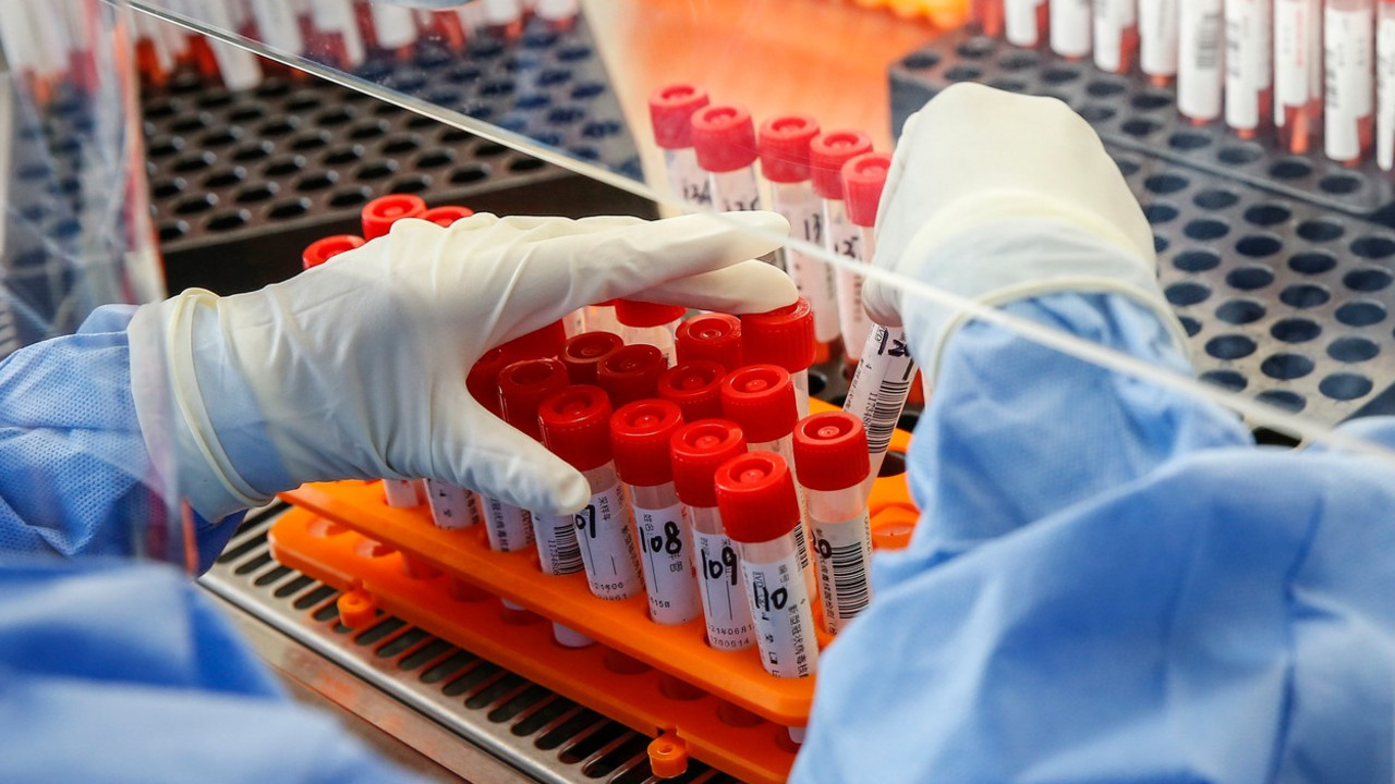 PCR test