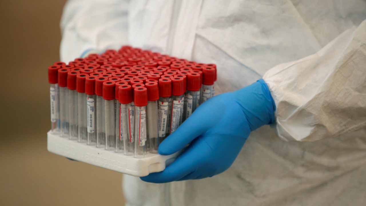 korona virus