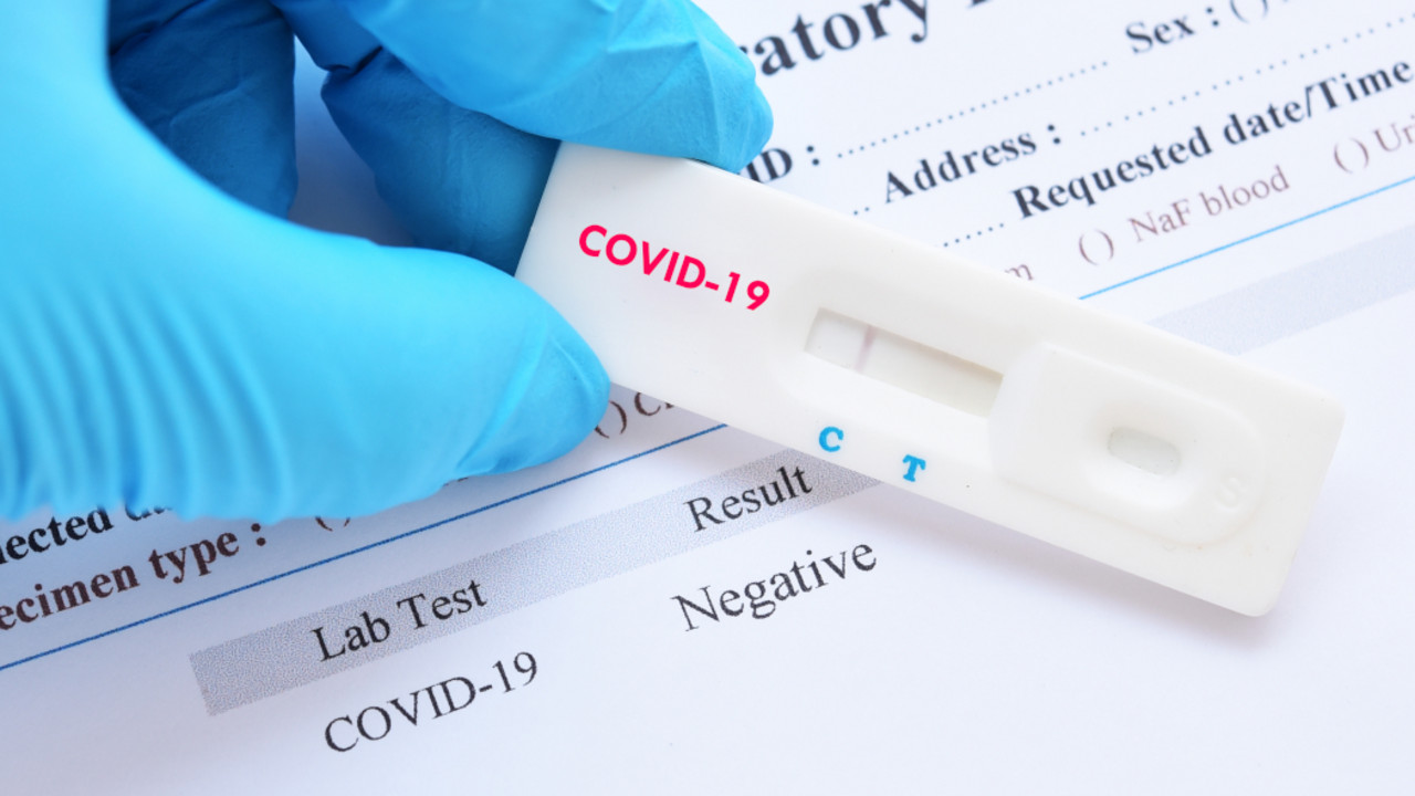 test na koronu