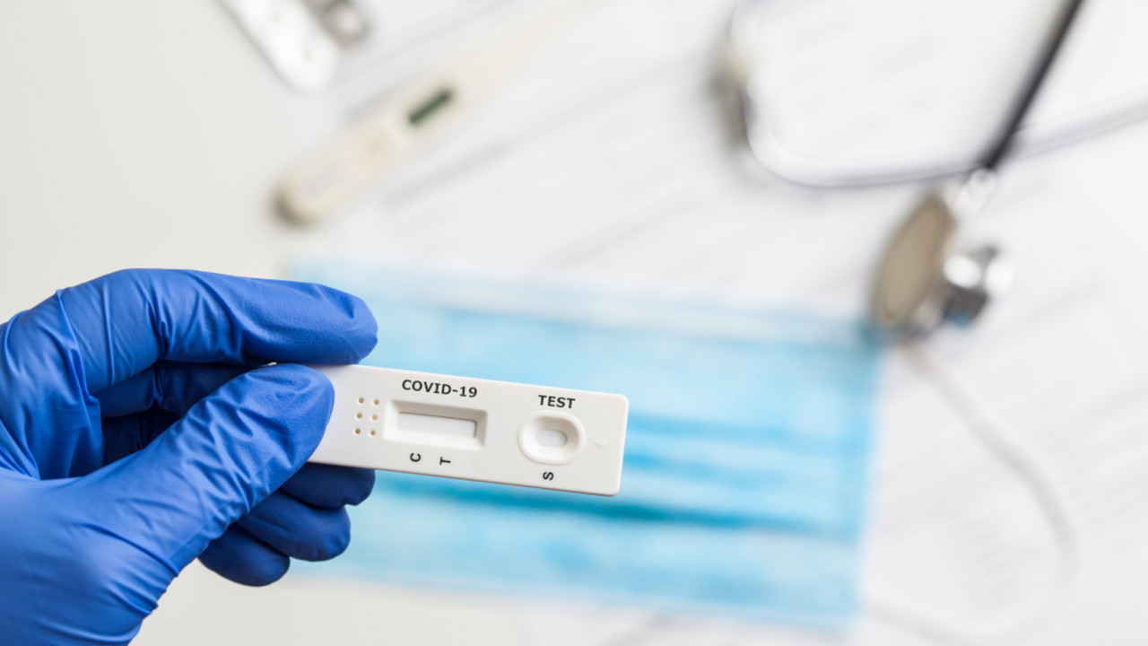 antigenski test