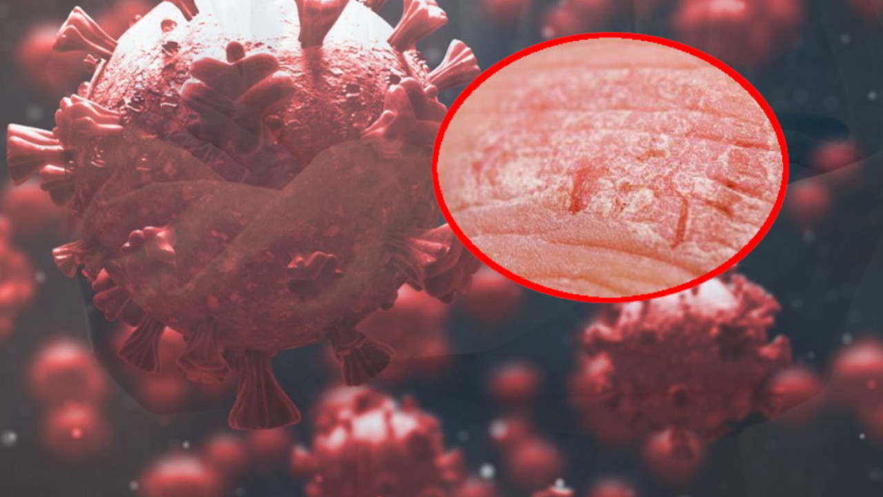 Korona virus