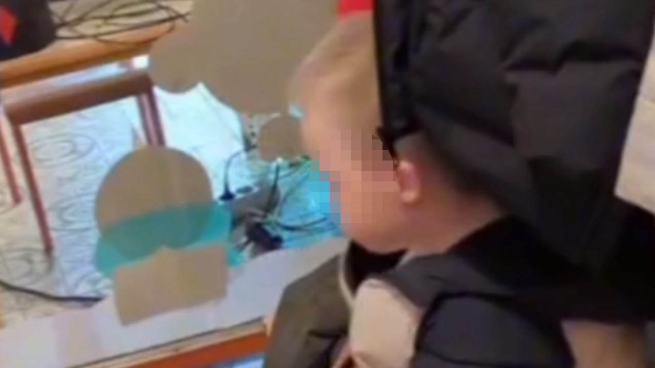 Dečak sa Daunovim sindromom