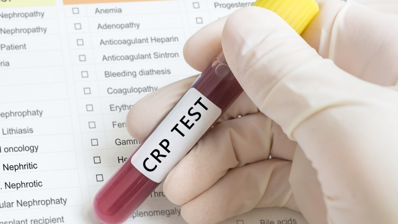 crp