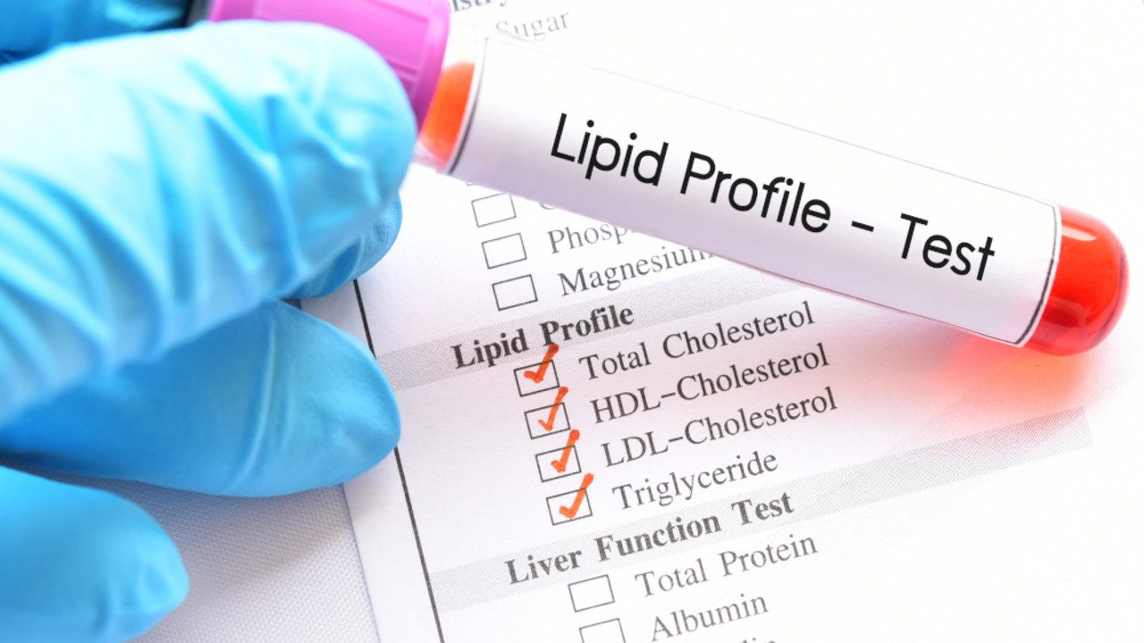 lipoprotein