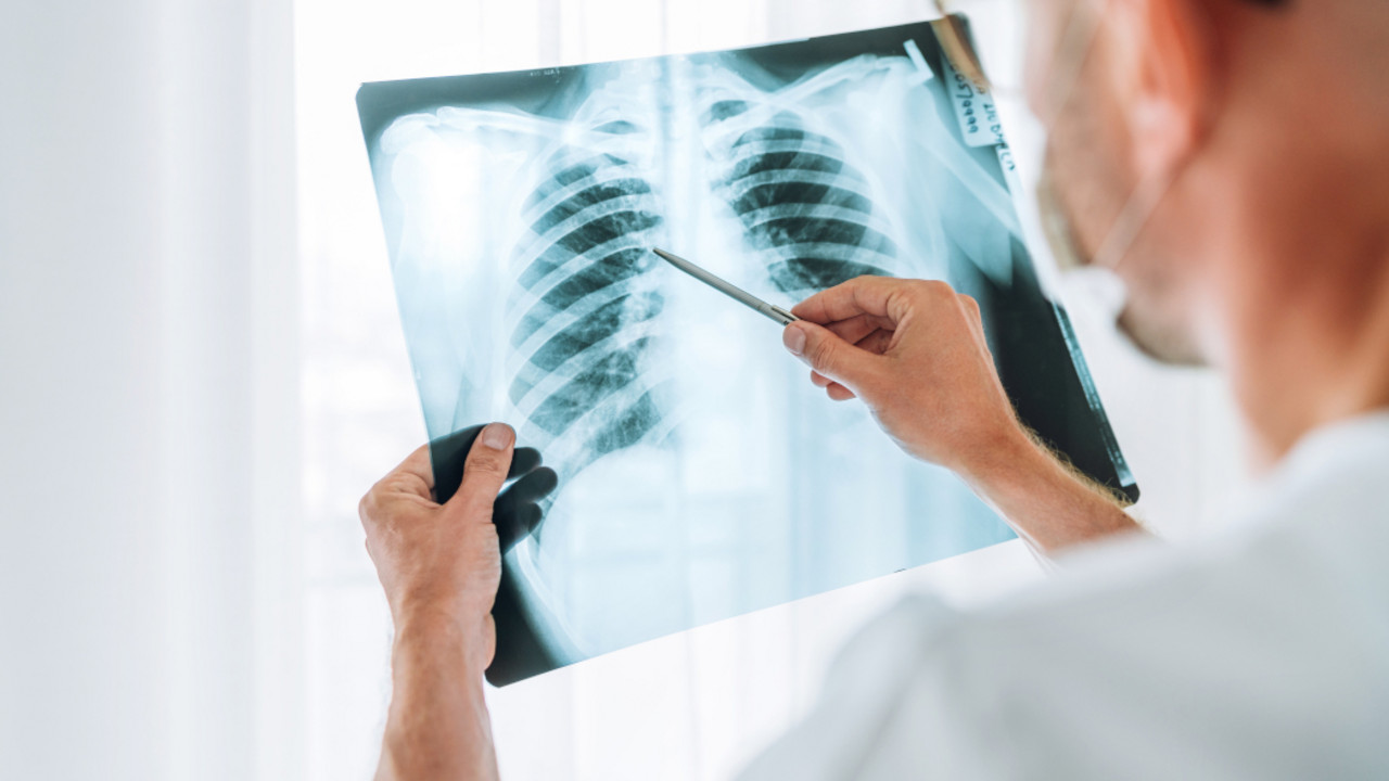 pluća, doktor