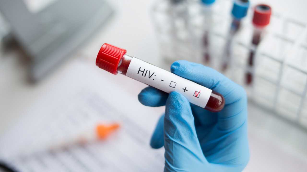 HIV