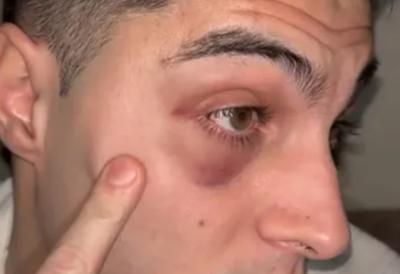 Poznati jutjuber napadnut na ulici: Zadobio povrede - Poznat po kontraverznom ponašanju i provociranju