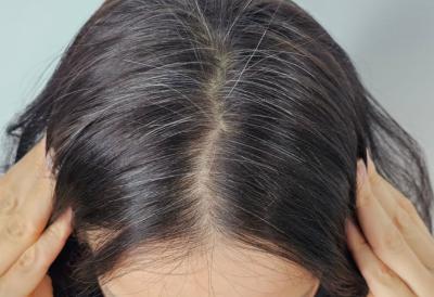 Tajni TRIK iskusnog frizera za NEOFARBANI IZRASTAK: U trenu prekriva sede, podmlađuje lice i kosi daje neverovatan volumen - bez farbanja