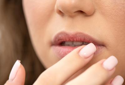 Usne su vam stalno suve i ispucale? Možda vam NEDOSTAJE OVAJ VITAMIN