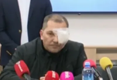 Brutalno napadnut član SNS u Darosavi: Ničim ovo nisam izazvao