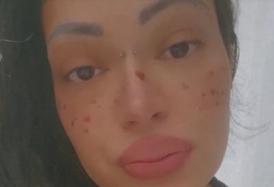 Zabrinjavajuće oglašavanje Dunje Ilić: "Mnogo sam bolesna, otkazala mi je leva strana tela..."