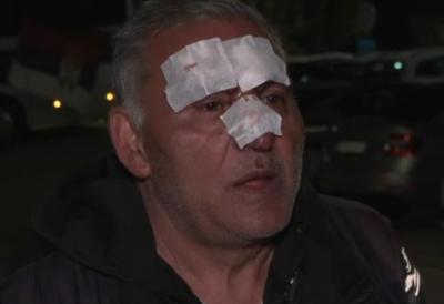 Blokaderi brutalno pretukli simpatizera SNS-a u Knjaževcu: Napali ga na kućnom pragu, oglasio se predsednik opštine