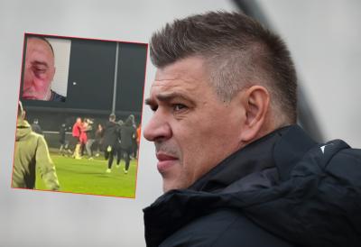 Pojavila se i fotografija PREBIJENOG FOTOGRAFA - zna se i KO je to uradio! Savo Milošević tek došao, a odmah OGROMNI problemi