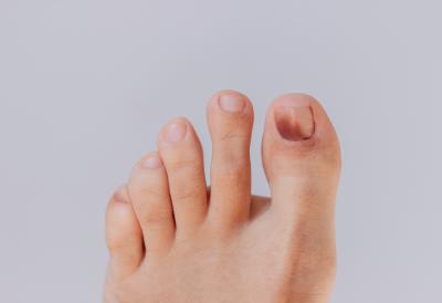 Upozorenje hirurga: "Modrica na noktu nije bezazlena, odvela je u smrt legendarnog muzičara (36)"