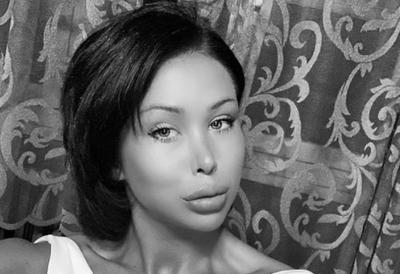 Napustila rijaliti zbog promena na licu i gubitka kose, sada se oglasila iz bolničkog kreveta: "I ovo ću pobediti"