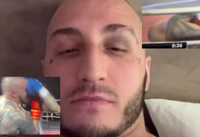 Vuk Mob se oglasio nakon što je nokautiran od Vasa Bakočevića: Reper pokazao modrice - "Malo eliksira pa možemo na sledećeg..."