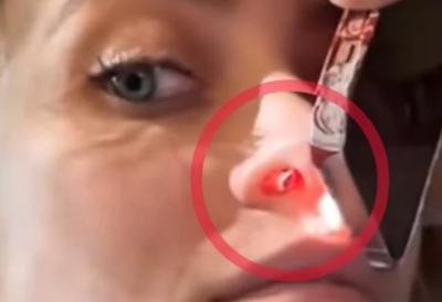 Ćerka slavnog pevača pokazala RUPU u nozdrvi zbog prekomernog konzumiranja nedozvoljenih supstanci, pa uputila apel: 