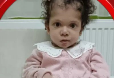 Mala Tara (7) vodi tešku borbu sa više dijagnoza - Pomozimo joj da nastavi terapije koje joj čuvaju napredak i život