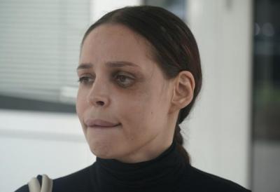 Šavija konačno pokazala lice posle operacija nakon teških povreda: Jedan detalj šokirao mnoge