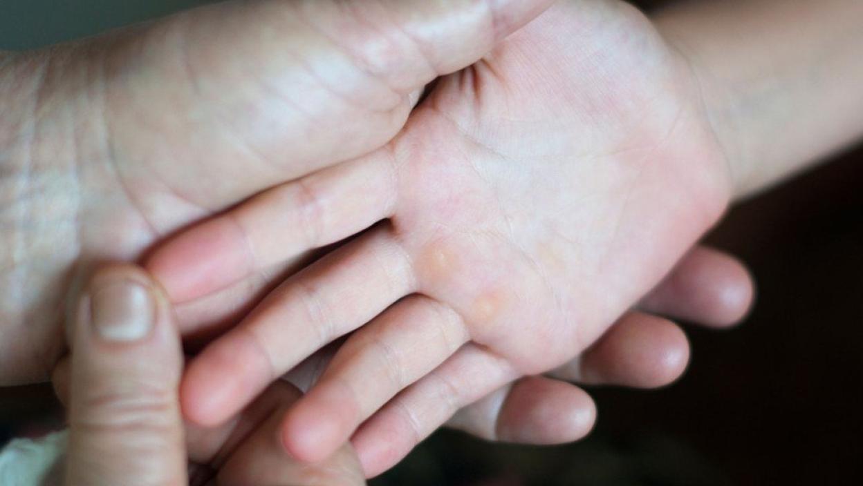 OTOCI, SLAB STISAK RUKE, PLAVI PRSTI: Evo šta vaši dlanovi otkrivaju o ...