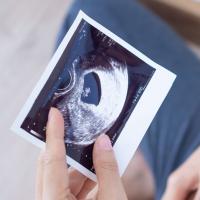 Ultrazvuk stomaka trudnice