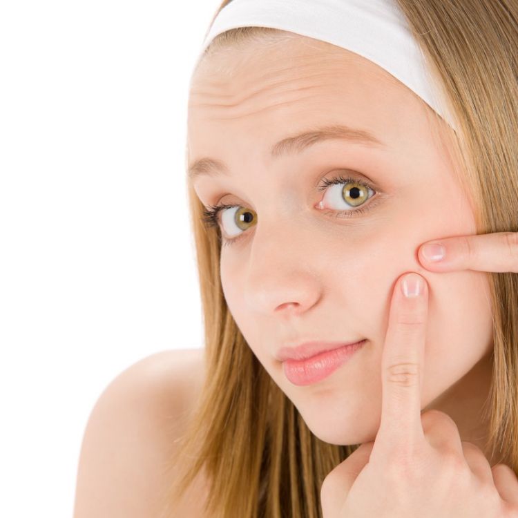 Почему нельзя давить. Прыщи в носогубном треугольнике. Почему нельзя давить. Почему нельзя давить прыщи подросткам. Носогубный треугольник.